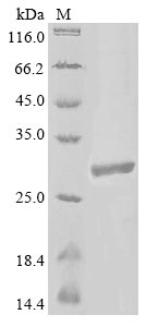 Greater than 85% as determined by SDS-PAGE.Recombinant Human Protein Mono-Adp-Ribosyltransferase Parp14 (PARP14) Protein (His&Myc)