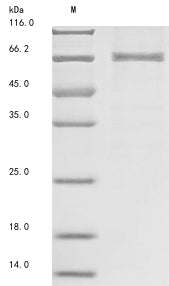 Greater than 85% as determined by SDS-PAGE.Recombinant Mouse 5'-Amp-Activated Protein Kinase Catalytic Subunit Alpha-1 (PRKAA1) Protein (GST&His)