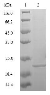 Greater than 85% as determined by SDS-PAGE.Recombinant Mouse Transcription Factor Mafk (MAFK) Protein (His&Myc)