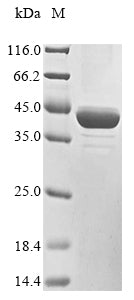 Greater than 85% as determined by SDS-PAGE.Recombinant Rat Dihydroorotate dehydrogenase (DHODH) Protein (His)