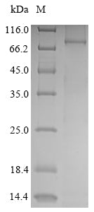 Greater than 85% as determined by SDS-PAGE.Recombinant Mouse Receptor-Interacting Serine/Threonine-Protein Kinase 1 (RIPK1) Protein (His&Myc)