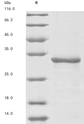 Greater than 85% as determined by SDS-PAGE.Recombinant Mouse Tripeptidyl-Peptidase 2 (TPP2) Protein (His&Myc)
