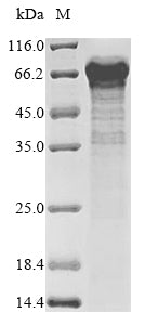 Greater than 85% as determined by SDS-PAGE.Recombinant Rat Probable E3 Ubiquitin-Protein Ligase Makorin-3 (MKRN3) Protein (His)