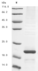 Greater than 85% as determined by SDS-PAGE.Recombinant Human Alk And Ltk Ligand 2 (ALKAL2) Protein (His&Myc)