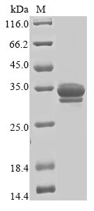 Greater than 85% as determined by SDS-PAGE.Recombinant Human Tripartite Motif-Containing Protein 72 (TRIM72) Protein (His&Myc)