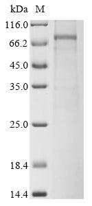Greater than 85% as determined by SDS-PAGE.Recombinant Human NAD (SARM1) Protein (His&Myc)