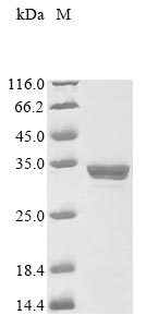 Greater than 85% as determined by SDS-PAGE.Recombinant Human Metapneumovirus Matrix Protein (M) Protein (His&Myc)