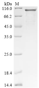 Greater than 90% as determined by SDS-PAGE.Recombinant Human Protein Mono-Adp-Ribosyltransferase Tiparp (TIPARP) Protein (His)