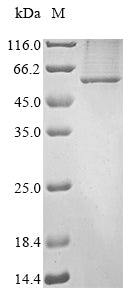 Greater than 85% as determined by SDS-PAGE.Recombinant Mouse Leucine-Rich Repeat Lgi Family Member 3 (LGI3) Protein (His&Myc)