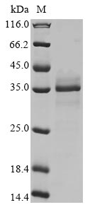 Greater than 85% as determined by SDS-PAGE.Recombinant Mouse Nad-Dependent Protein Deacylase Sirtuin-5, Mitochondrial (SIRT5) Protein (His&Myc)