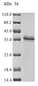 Greater than 85% as determined by SDS-PAGE.Recombinant Mouse 17-Beta-Hydroxysteroid Dehydrogenase 13 (HSD17B13) Protein (His&Myc)