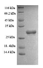 Greater than 90% as determined by SDS-PAGE.Recombinant Human Swi/Snf Complex Subunit Smarcc1 (SMARCC1) Protein (His)