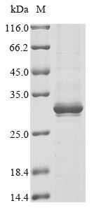 Greater than 85% as determined by SDS-PAGE.Recombinant Human Alpha-Protein Kinase 1 (ALPK1) Protein (His&Myc)
