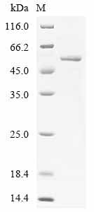 Greater than 90% as determined by SDS-PAGE.Recombinant Human Protein Cereblon (CRBN) Protein (His)