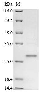 Greater than 85% as determined by SDS-PAGE.Recombinant Mouse Placenta-Expressed Transcript 1 Protein (PLET1) Protein (His)