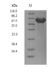 Greater than 90% as determined by SDS-PAGE.Recombinant Human Dual Specificity Tyrosine-Phosphorylation-Regulated Kinase 2 (DYRK2) Protein (His)