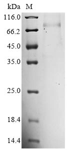 Greater than 85% as determined by SDS-PAGE.Recombinant Mouse Mannan-Binding Lectin Serine Protease 2 (MASP2) Protein (His)