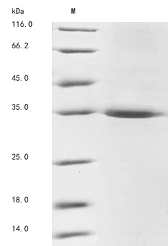 Greater than 90% as determined by SDS-PAGE.Recombinant Mouse Lim And Senescent Cell Antigen-Like-Containing Domain Protein 1 (LIMS1) Protein (His)
