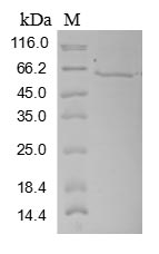 Greater than 85% as determined by SDS-PAGE.Recombinant Human Three-Prime Repair Exonuclease 1 (TREX1) Protein (MBP&His)