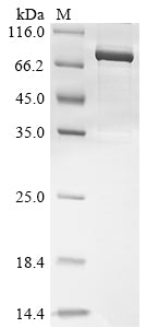 Greater than 85% as determined by SDS-PAGE.Recombinant Human Poly [Adp-Ribose] Polymerase 2 (PARP2) Protein (GST&His)