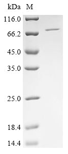 Greater than 90% as determined by SDS-PAGE.Recombinant Human Poly [Adp-Ribose] Polymerase 2 (PARP2) Protein (His)