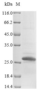 Greater than 85% as determined by SDS-PAGE.Recombinant Mouse Sclerostin Domain-Containing Protein 1 (SOSTDC1) Protein (His&Myc)