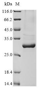 Greater than 85% as determined by SDS-PAGE.Recombinant Rattus Norvegicus Comm Domain-Containing Protein 5 (COMMD5) Protein (His&Myc)