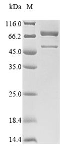 Greater than 85% as determined by SDS-PAGE.Recombinant Mouse Peroxisomal Acyl-Coenzyme A Oxidase 1 (ACOX1) Protein (His&Myc)