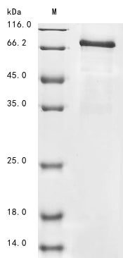 Greater than 85% as determined by SDS-PAGE.Recombinant Mouse Procollagen-Lysine,2-Oxoglutarate 5-Dioxygenase 2 (PLOD2) Protein (His-Myc)