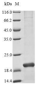Greater than 90% as determined by SDS-PAGE.Recombinant Human Iron-Sulfur Cluster Assembly Enzyme Iscu, Mitochondrial (ISCU) Protein (His&Myc)