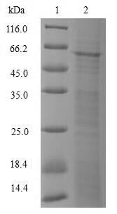 Greater than 85% as determined by SDS-PAGE.Recombinant Human Dna-Directed Dna/Rna Polymerase Mu (POLM) Protein (His&Myc)