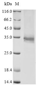 Greater than 90% as determined by SDS-PAGE.