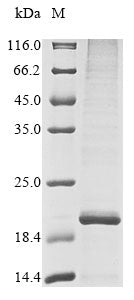 Greater than 85% as determined by SDS-PAGE.Recombinant Human Sal-Like Protein 4 (SALL4) Protein (His&Myc)