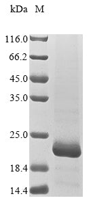 Greater than 85% as determined by SDS-PAGE.