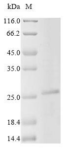 Greater than 85% as determined by SDS-PAGE.Recombinant Mouse Troponin I, Slow Skeletal Muscle (TNNI1) Protein (His&Myc)