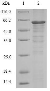 Greater than 90% as determined by SDS-PAGE.Recombinant Human Receptor-Interacting Serine/Threonine-Protein Kinase 3 (RIPK3) Protein (His&Myc)