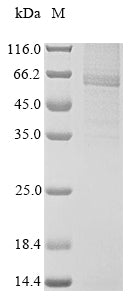 Greater than 85% as determined by SDS-PAGE.Recombinant Rat Receptor-Interacting Serine/Threonine-Protein Kinase 3 (RIPK3) Protein (His&Myc)