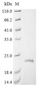 Greater than 90% as determined by SDS-PAGE.Recombinant Human Claudin-1 (CLDN1) Protein (His)
