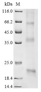 Greater than 85% as determined by SDS-PAGE.Recombinant Human Claudin-11 (CLDN11) Protein (His)