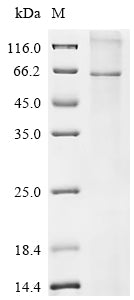 Greater than 90% as determined by SDS-PAGE.Recombinant Human Glucagon-Like Peptide 2 Receptor (GLP2R) Protein (His)