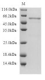 Greater than 90% as determined by SDS-PAGE.Recombinant Human 5-Hydroxytryptamine Receptor 1B (HTR1B) Protein (His-SUMO)