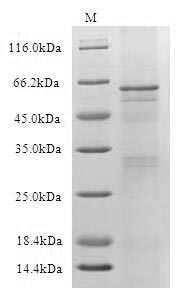 Greater than 90% as determined by SDS-PAGE.Recombinant Human Muscle, Skeletal Receptor Tyrosine-Protein Kinase (MUSK) Protein (His), Active