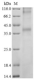 Greater than 85% as determined by SDS-PAGE.Recombinant Human Long-Wave-Sensitive Opsin 1 (OPN1LW) Protein (His)