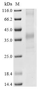 Greater than 85% as determined by SDS-PAGE.Recombinant Human Delta-Type Opioid Receptor (OPRD1) Protein (His)