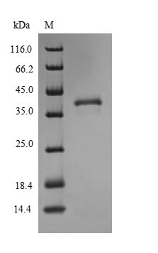 Greater than 90% as determined by SDS-PAGE.Recombinant Human High Affinity Copper Uptake Protein 1 (SLC31A1) Protein (His-SUMO), Active