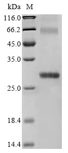 Greater than 90% as determined by SDS-PAGE.Recombinant Human 3-Oxo-5-Alpha-Steroid 4-Dehydrogenase 1 (SRD5A1) Protein (His)