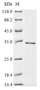 Greater than 85% as determined by SDS-PAGE.