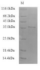 Greater than 90% as determined by SDS-PAGE.Recombinant Bacillus Subtilis Uncharacterized Protein Yuab (YUAB) Protein (His-SUMO), Active