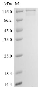 Greater than 85% as determined by SDS-PAGE.Recombinant Gossypium Hirsutum Cellulose Synthase (LOC107958683) Protein (His)