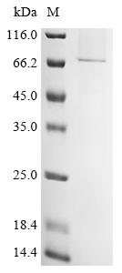Greater than 85% as determined by SDS-PAGE.Recombinant Measles Virus Hemagglutinin Glycoprotein (H) Protein (His)